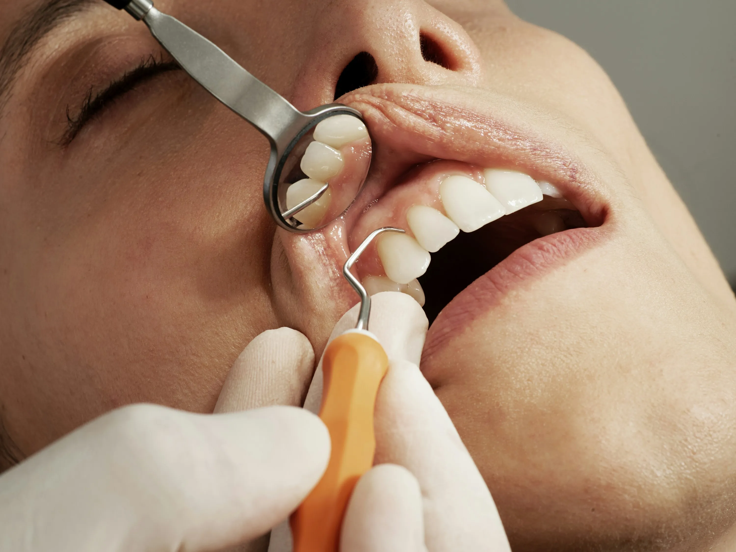 Periodontal examination